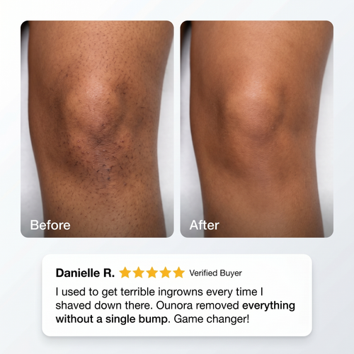 Ounora - Intimate Hair Removal Kit