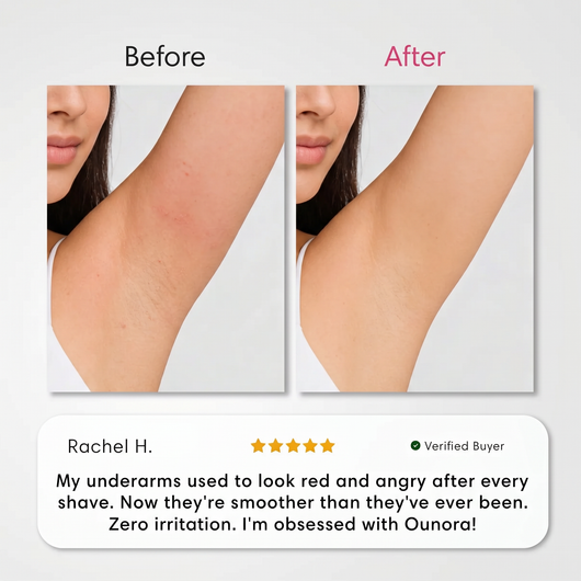 Ounora - Intimate Hair Removal Kit